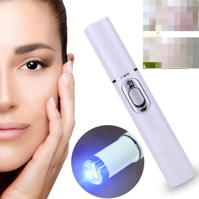 Caneta  Removedora de Rugas, Acnes e Varizes - Laser Pen | Tratamento Estético em Casa