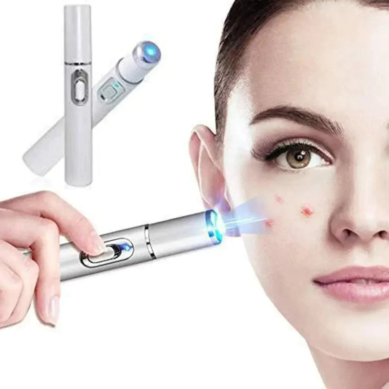 Caneta  Removedora de Rugas, Acnes e Varizes - Laser Pen | Tratamento Estético em Casa